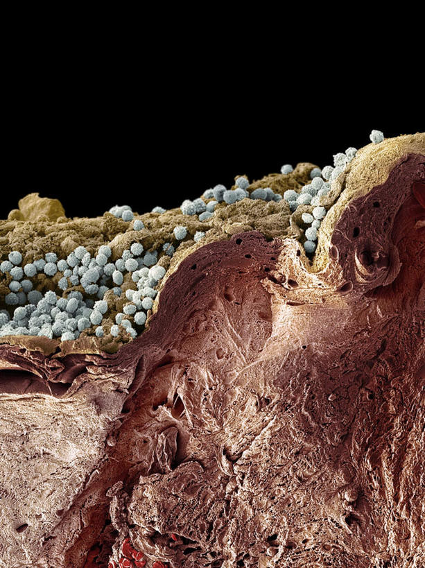 无人,竖图,俯视,室内,白天,仪器,微生物,黑色背景,检查,反射,分析,科学,红血球,医学,细胞,显微镜,观察,清晰,探索,放大,观看,仔细,透镜,疾病,生物学,血细胞,凸透镜,聚焦,关注,皮肤病,光学,清楚,红细胞,彩图,高角度拍摄,脓皮病