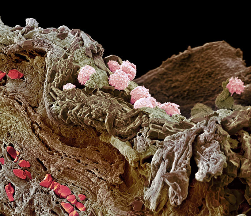 无人,横图,俯视,室内,白天,仪器,微生物,黑色背景,检查,反射,分析,科学,红血球,医学,细胞,显微镜,观察,清晰,探索,放大,观看,仔细,透镜,疾病,生物学,血细胞,凸透镜,聚焦,关注,皮肤病,光学,清楚,红细胞,彩图,高角度拍摄,脓皮病