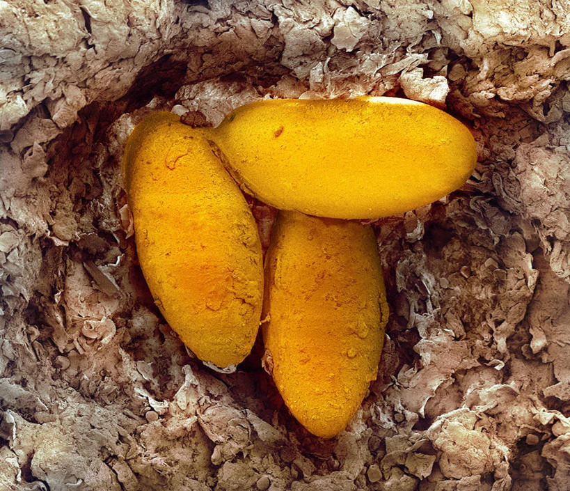 无人,横图,俯视,室内,白天,仪器,野生动物,检查,反射,分析,科学,细菌,显微镜,动物,观察,清晰,探索,放大,观看,皮肤,仔细,透镜,凸透镜,聚焦,关注,皮肤病,病菌,光学,清楚,传染,寄生虫,螨虫,彩图,高角度拍摄,疥癣