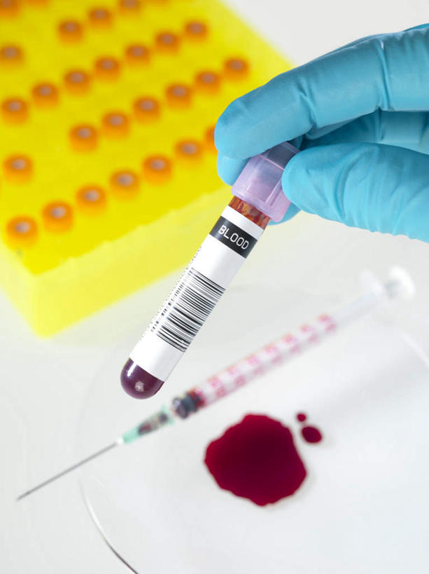 西方人,一个人,医生,捏,竖图,俯视,室内,特写,白天,安全,电子,实验,仪器,杯子,欧洲,欧洲人,仅一个年轻女性,仅一个女性,仅一个人,握,朦胧,模糊,研究,透明,分析,信息,化学,测试,英文,标签,标志,符号,试管,试管架,数字,文字,字符,字母,防护,拿,捏着,拿着,标识,架子,玻璃制品,玻璃瓶,瓶子,手套,医护人员,医疗人员,器皿,血液,针管,针筒,握着,注射,英文字母,保护,条形码,医疗,医疗设备,注射器,编码,保险,条码,计量,鲜血,玻璃仪器,试验耗材,实验用品,保全,周全,安稳,安定,防护手套,平安,年轻女性,女人,女性,白种人,大夫,玻璃杯,半身,彩图,高角度拍摄,商业