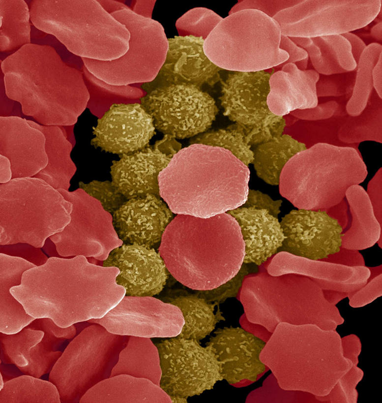 无人,竖图,俯视,室内,白天,仪器,微生物,许多,检查,反射,分析,科学,红血球,医学,细胞,显微镜,观察,清晰,探索,放大,观看,仔细,透镜,生物学,血细胞,凸透镜,聚焦,关注,白细胞,光学,清楚,红细胞,电镜,彩图,高角度拍摄