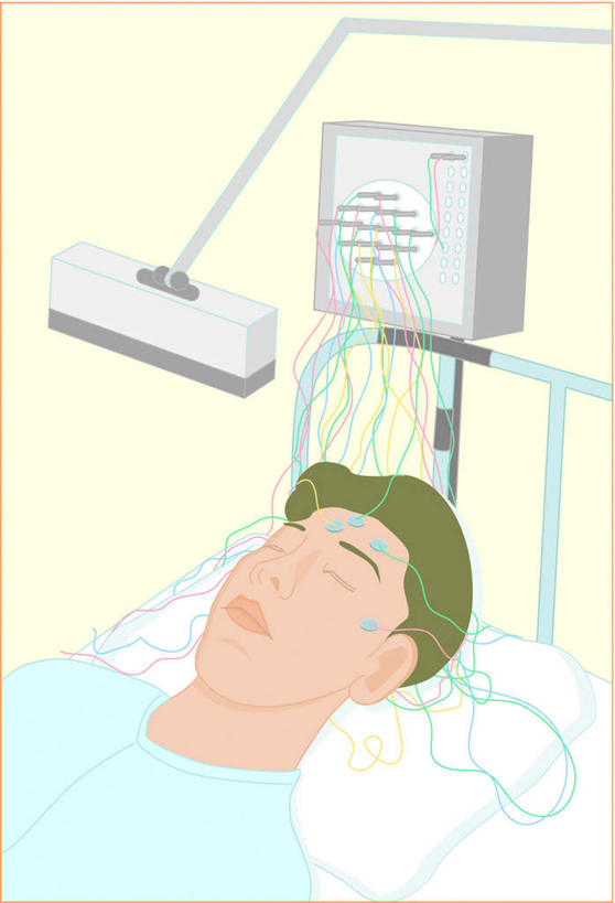 东方人,一个人,无人,病人,躺,闭眼,竖图,俯视,插画,室内,白天,工作服,制服,数码,科技,床,亚洲,仅一个男性,仅一个人,阴影,网络,墙,床单,高光,几何,计算机图形,合成,图画,黄种人,被子,墙壁,墙面,画,仅一个年轻男性,单人床,电脑合成图,数码合成图,被单,漫画,脑电波,写实,具体,具象,工作制服,卧着,男人,男性,年轻男性,亚洲人,患者,就医者,闭眼睛,闭着眼,闭着眼睛,躺着,卧,半身,彩图,高角度拍摄,工作套服