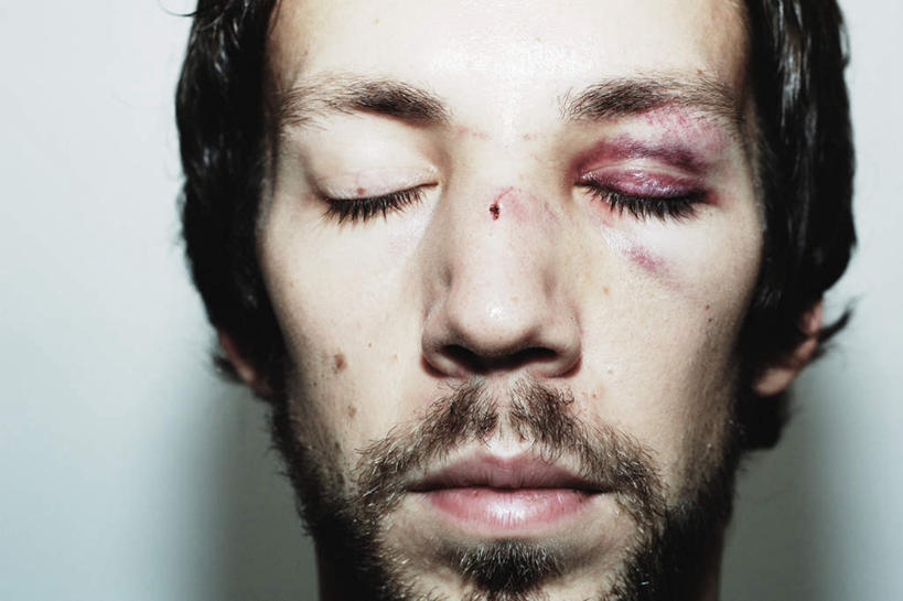 西方人,脸,头,鼻子,嘴,脸颊,胡须,一个人,闭眼,横图,室内,特写,白天,正面,欧洲,欧洲人,仅一个男性,仅一个人,仅一个中年男性,伤痕,男人,男性,中年男性,白种人,头部,胡子,络腮胡,鼻,鼻孔,脸部,脸蛋,面部,嘴巴,嘴唇,闭眼睛,闭着眼,闭着眼睛,半身,彩图