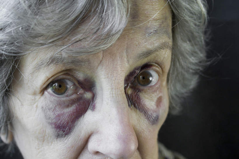 西方人,脸,头,脸颊,一个人,站,横图,俯视,室内,特写,白天,房间,欧洲,欧洲人,仅一个女性,仅一个人,阴影,光线,影子,墙,灯光,注视,墙壁,墙面,观察,看,站着,仅一个老年女性,观看,察看,关注,瘀青,老年女性,女人,女性,白种人,头部,脸部,脸蛋,面部,站立,半身,彩图,高角度拍摄