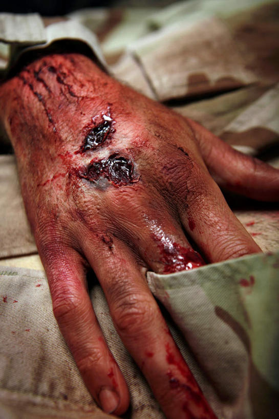手,一个人,站,竖图,室内,特写,白天,仅一个男性,仅一个人,仅一个中年男性,服装,军事,血,口袋,衣服,站着,手部,服饰,肮脏,暴力,衣着,穿着,受伤,邋遢,烧伤,衣饰,血腥,龌龊,污秽,恶浊,男人,男性,中年男性,站立,半身,彩图
