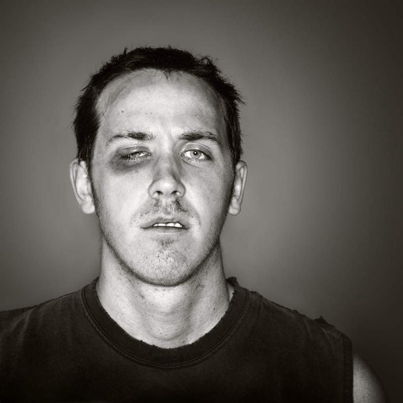 西方人,脸,头,眼睛,鼻子,嘴,耳朵,脸颊,眉毛,睫毛,一个人,站,方图,室内,白天,正面,欧洲,欧洲人,瞳孔,仅一个男性,仅一个人,阴影,服装,反射,影子,注视,休闲装,仅一个年轻男性,衣服,观察,看,站着,休闲,休闲服,眼部,服饰,观看,察看,关注,受伤,男人,男性,年轻男性,白种人,头部,鼻,鼻孔,耳,耳部,睫,口,口腔,脸部,脸蛋,眉,面部,眼,眼睫毛,眼眉,嘴巴,嘴唇,站立,半身,彩图,淤青,眼眉毛