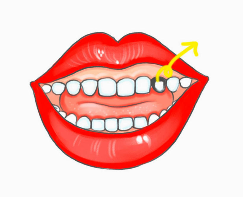 嘴,牙齿,一个人,无人,横图,插画,室内,白天,白色背景,正面,数码,科技,仅一个年轻女性,仅一个女性,仅一个人,阴影,网络,高光,几何,计算机图形,合成,图画,方向,箭头,画,黄色,红色,电脑合成图,数码合成图,蛀牙,指向,合成图,漫画,写实,具体,具象,簇,年轻女性,女人,女性,齿,口,口腔,牙,牙龈,嘴巴,嘴唇,半身,彩图