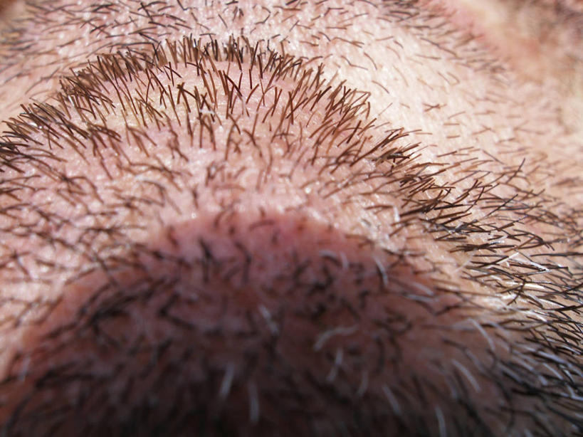 西方人,下巴,胡须,一个人,横图,室外,特写,白天,正面,欧洲,欧洲人,仅一个男性,仅一个人,阴影,光线,影子,仅一个年轻男性,阳光,皮肤,男人,男性,年轻男性,白种人,胡子,络腮胡,半身,彩图