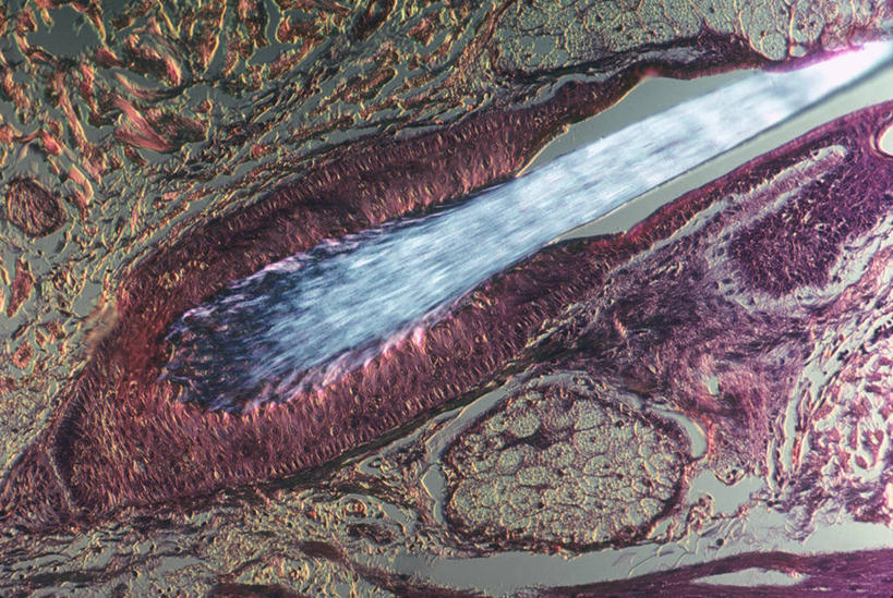 无人,横图,室内,特写,白天,正面,微距,神秘,仪器,微生物,阴影,检查,反射,分析,科学,医学,纹路,纹理,细胞,显微镜,影子,紫色,观察,清晰,探索,放大,观看,仔细,透镜,生物学,优美,凸透镜,聚焦,庄重,高贵,关注,消极,毛球,肌理,光学,清楚,毛囊,皮脂腺,冷色,显微图片,自然科学,博物学,生物科学,孤寂,彩图,微距摄影,泡状腺,毛乳头,奢华