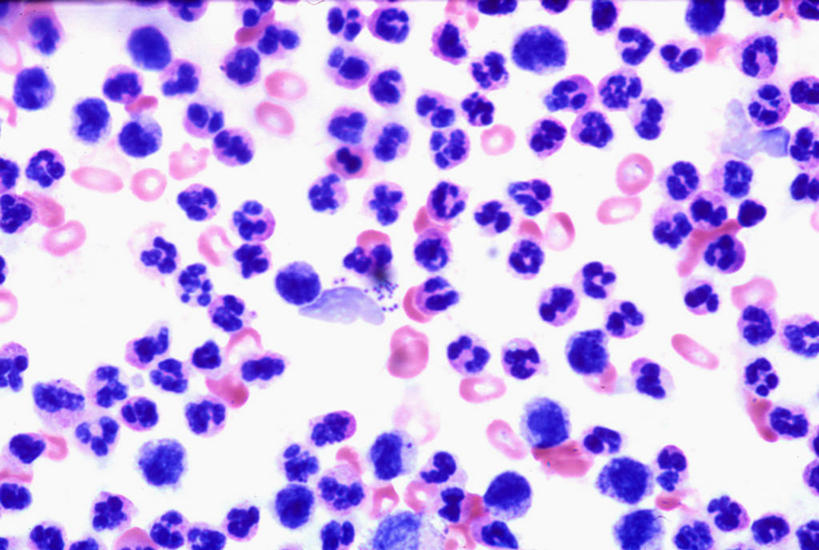 无人,横图,室内,特写,白天,白色背景,正面,微距,仪器,微生物,阴影,检查,反射,分析,科学,细菌,显微镜,影子,粉色,紫色,观察,清晰,探索,放大,观看,仔细,透镜,凸透镜,聚焦,关注,光学,清楚,生命体,葡萄球菌,金黄色葡萄球菌,耐甲氧西林金黄色葡萄球菌,显微图片,彩图,微距摄影,感染