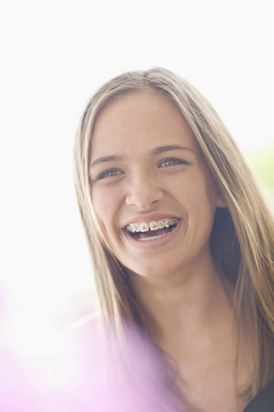 西方人,脸,头,脸颊,头发,一个人,笑,微笑,竖图,室外,特写,白天,正面,泳装,比基尼,欧洲,欧洲人,仅一个年轻女性,仅一个女性,仅一个人,阴影,朦胧,模糊,光线,影子,注视,肩膀,阳光,模型,观察,看,金色,模具,观看,察看,关注,矫正,牙科,牙套,牙箍,校正,校准,牙饰,年轻女性,女人,女性,白种人,头部,脸部,脸蛋,面部,半身,彩图,三点式,泳衣,矫正器