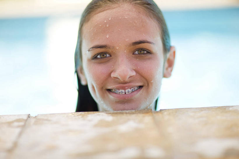 西方人,脸,头,脸颊,头发,一个人,体育馆,游泳池,笑,微笑,露齿笑,横图,室外,特写,白天,正面,水,欧洲,欧洲人,仅一个年轻女性,仅一个女性,仅一个人,阴影,朦胧,模糊,光线,瓷砖,地砖,影子,水池,水面,地面,注视,泳池,阳光,模型,观察,看,模具,观看,察看,游泳馆,关注,矫正,牙科,牙套,牙箍,校正,校准,牙饰,年轻女性,女人,女性,白种人,头部,长发,脸部,脸蛋,面部,半身,彩图,矫正器