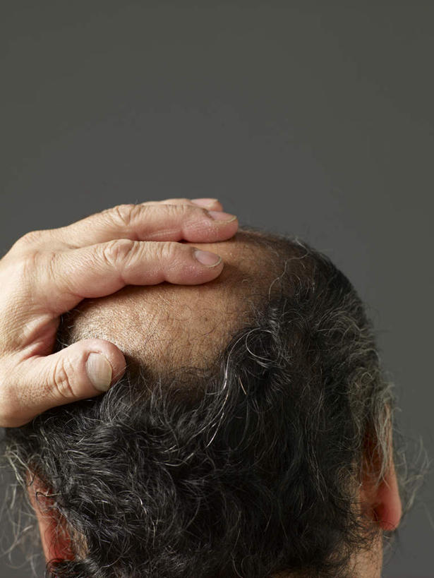 东方人,手,秃头,一个人,摸,竖图,室内,特写,白天,白色背景,亚洲,仅一个男性,仅一个人,仅一个中年男性,抚摸,阴影,反射,影子,黄种人,背面,手部,摄影,影棚,单手,男人,男性,中年男性,亚洲人,光头,无发,触摸,接触,半身,彩图,影棚拍摄,拍摄