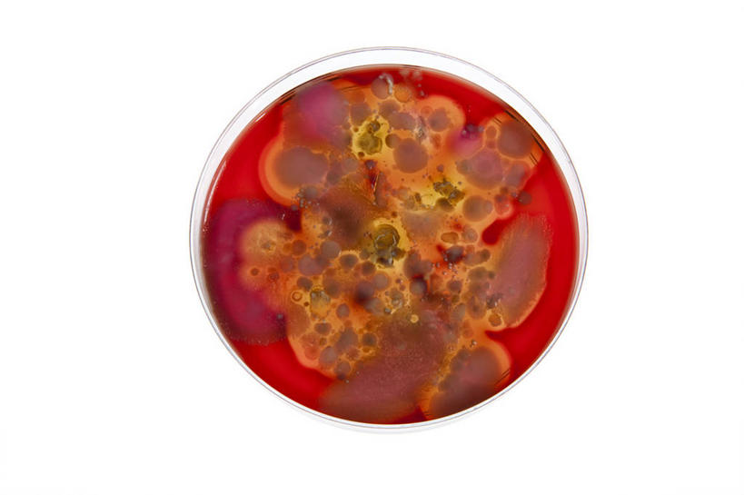 无人,横图,俯视,室内,特写,白天,白色背景,实验,仪器,微生物,研究,分析,化学,细菌,测试,培养皿,一个,红色,器皿,生物,摄影,影棚,单个,皮氏培养皿,试验耗材,实验用品,化学器材,生命体,彩图,高角度拍摄,影棚拍摄,拍摄,原核生物