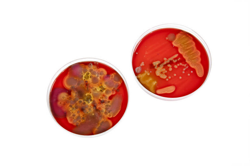 无人,横图,俯视,室内,特写,白天,白色背景,实验,仪器,微生物,研究,分析,化学,细菌,测试,培养皿,两个,红色,器皿,生物,摄影,影棚,皮氏培养皿,试验耗材,实验用品,化学器材,生命体,彩图,高角度拍摄,影棚拍摄,拍摄,原核生物