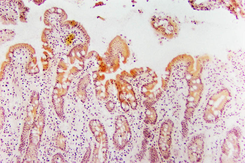 无人,横图,俯视,室内,特写,白天,仪器,微生物,检查,反射,分析,科学,医学,纹路,纹理,细胞,显微镜,观察,粘液,清晰,探索,放大,观看,仔细,透镜,生物学,凸透镜,聚焦,关注,黏液,神经元,肌理,光学,清楚,神经细胞,小肠,彩图,高角度拍摄