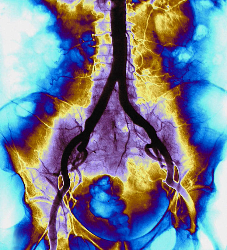 脑,无人,竖图,彩色,x光片,室内,特写,白天,白色背景,正面,静物,辐射,科学,医学,医疗,科学技术,x射线,x光,脑部,脑子,彩图,电磁波,电磁辐射