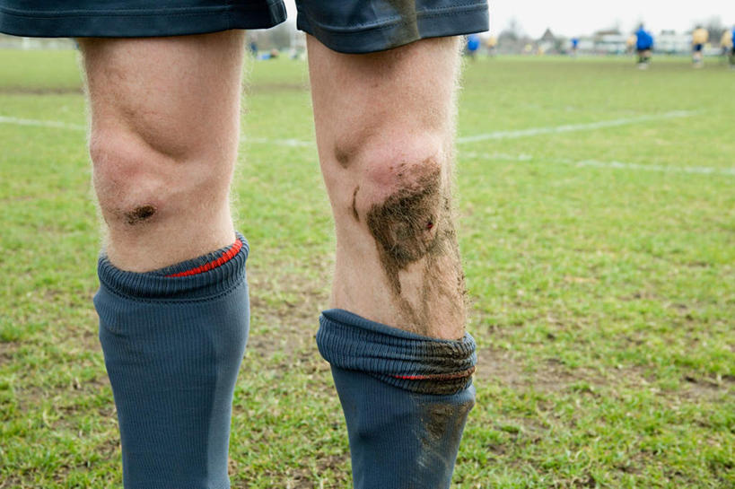 西方人,一个人,运动员,足球场,站,横图,室外,白天,正面,运动服,草地,草坪,植物,欧洲,欧洲人,仅一个男性,仅一个人,服装,朦胧,模糊,袜子,草,仅一个年轻男性,衣服,绿色,天空,天,站着,服饰,肮脏,晴朗,长袜,衣着,穿着,受伤,绿茵场,长筒袜,邋遢,万里无云,衣饰,龌龊,污秽,流血,长统袜,男人,男性,年轻男性,白种人,晴空,晴空万里,体育运动员,运动选手,站立,半身,彩图,足球比赛场地,运动装