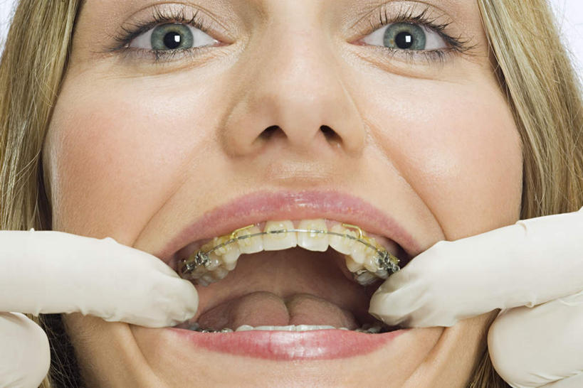 脸,头,脸颊,手,一个人,站,横图,室内,特写,白天,白色背景,正面,双手,仅一个年轻女性,仅一个女性,仅一个人,握,阴影,反射,影子,拿,拿着,注视,肩膀,模型,手套,观察,看,站着,张嘴,手部,橡胶,握着,摄影,影棚,模具,观看,察看,关注,矫正,牙科,橡胶手套,牙套,张大嘴巴,橡胶制品,牙箍,医用手套,校正,校准,牙饰,年轻女性,女人,女性,头部,脸部,脸蛋,面部,张开嘴,站立,半身,彩图,影棚拍摄,拍摄