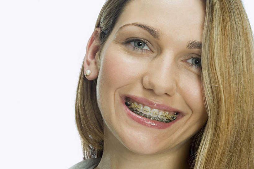 西方人,脸,头,脸颊,脖子,头发,一个人,笑,微笑,露齿笑,横图,室内,特写,白天,白色背景,正面,欧洲,欧洲人,仅一个年轻女性,仅一个女性,仅一个人,注视,模型,观察,看,金色,摄影,影棚,模具,观看,察看,关注,矫正,牙科,牙套,牙箍,校正,校准,牙饰,年轻女性,女人,女性,白种人,头部,脖,颈,颈部,脸部,脸蛋,面部,半身,彩图,影棚拍摄,拍摄