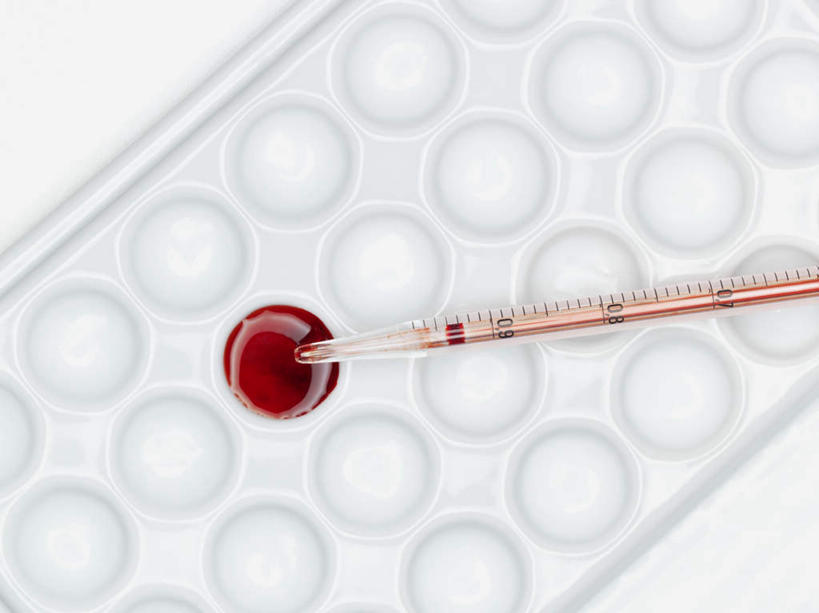 无人,横图,俯视,室内,特写,白天,白色背景,实验,仪器,静物,研究,透明,分析,化学,测试,滴管,盘,试管,液体,玻璃制品,一个,红色,器皿,摄影,影棚,单个,计量,玻璃仪器,试验耗材,实验用品,吸液管,移液管,彩图,高角度拍摄,影棚拍摄,拍摄