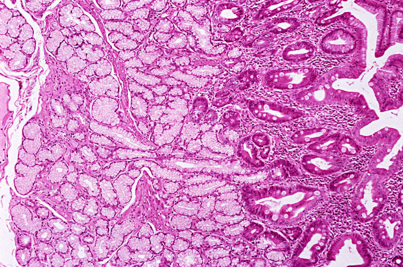 无人,横图,俯视,室内,特写,白天,微生物,检查,分析,科学,医学,细胞,紫色,观察,清晰,探索,放大,观看,仔细,生物学,聚焦,关注,清楚,显微图片,彩图,高角度拍摄
