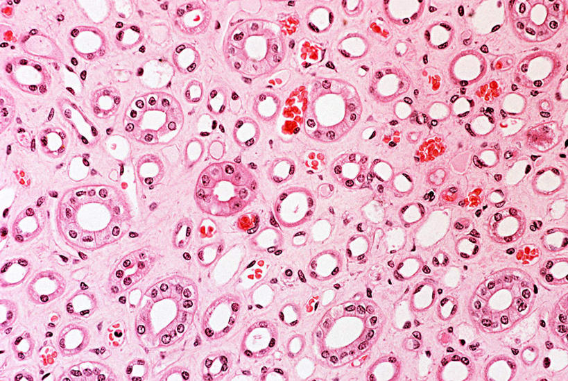 无人,横图,俯视,室内,特写,白天,微生物,检查,分析,科学,医学,细胞,紫色,观察,清晰,探索,放大,观看,仔细,生物学,聚焦,关注,清楚,髓鞘,显微图片,彩图,高角度拍摄
