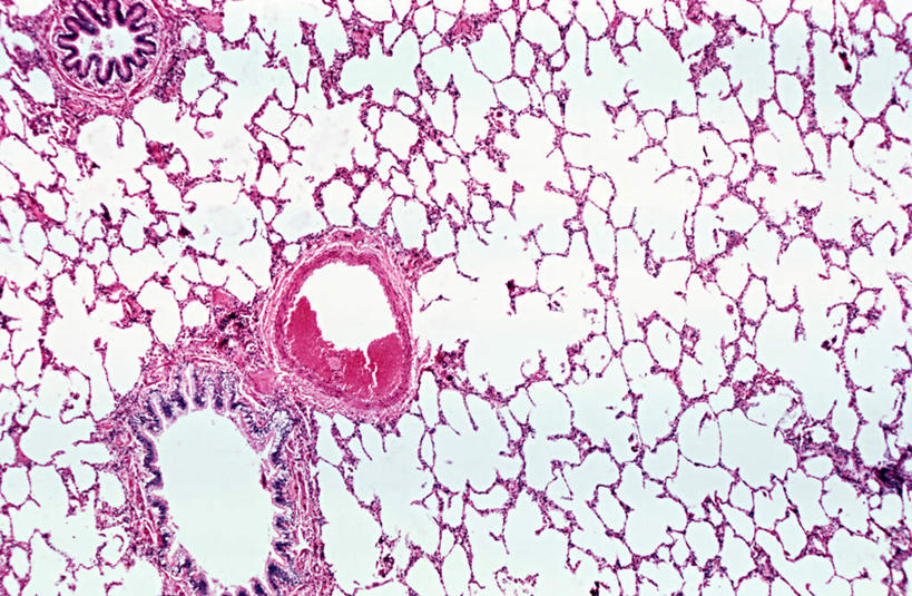 子宫,无人,横图,室内,特写,白天,正面,仪器,微生物,切开,检查,反射,分析,科学,医学,细胞,显微镜,粉色,观察,切,清晰,探索,放大,观看,仔细,透镜,生物学,凸透镜,聚焦,关注,剖面,切面,光学,清楚,显微图片,彩图