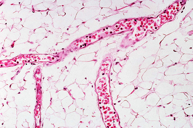 子宫,无人,横图,室内,特写,白天,正面,仪器,微生物,切开,检查,反射,分析,科学,医学,细胞,显微镜,粉色,观察,切,清晰,探索,放大,观看,仔细,透镜,生物学,凸透镜,聚焦,关注,剖面,切面,光学,清楚,显微图片,彩图