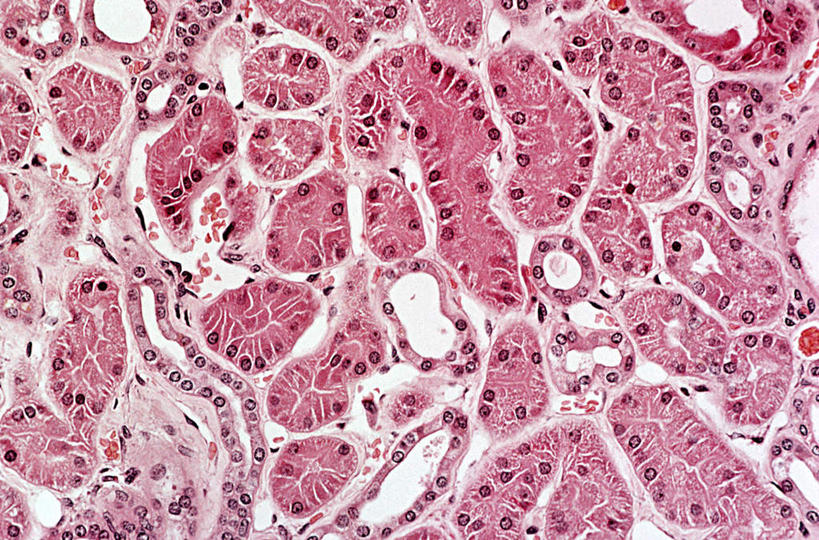 毛细血管,无人,横图,室内,特写,白天,正面,仪器,微生物,切开,检查,反射,分析,科学,医学,细胞,显微镜,粉色,观察,切,清晰,探索,放大,观看,仔细,透镜,生物学,凸透镜,聚焦,关注,剖面,切面,光学,清楚,显微图片,彩图