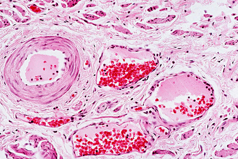 子宫,无人,横图,室内,特写,白天,正面,仪器,微生物,切开,检查,反射,分析,科学,医学,细胞,显微镜,粉色,观察,切,清晰,探索,放大,观看,仔细,透镜,生物学,凸透镜,聚焦,关注,剖面,切面,光学,清楚,显微图片,彩图