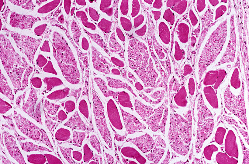 食道,肌肉,健壮,无人,横图,室内,特写,白天,正面,微生物,阴影,反射,科学,医学,纹路,纹理,细胞,影子,粉色,健康,活力,力量,青春,生物学,强壮,横截面,肌理,显微图片,彩图