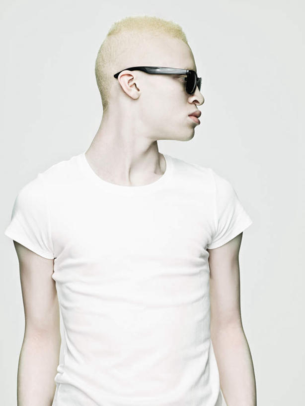 西方人,一个人,站,竖图,室内,白天,白色背景,正面,欧洲,非洲,黑人,欧洲人,仅一个男性,仅一个人,服装,墨镜,眼镜,扭头,注视,休闲装,仅一个年轻男性,衣服,白色,太阳镜,太阳眼镜,观察,看,站着,转头,休闲,生病,休闲服,遮阳镜,摄影,服饰,影棚,观看,察看,关注,抱病,白化病,男人,男性,年轻男性,非洲人,站立,半身,彩图,影棚拍摄,拍摄