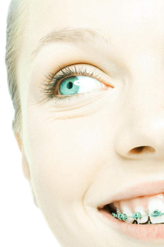 西方人,脸,头,眼睛,脸颊,一个人,笑,微笑,露齿笑,竖图,室内,特写,白天,白色背景,正面,欧洲,欧洲人,瞳孔,仅一个年轻女性,仅一个女性,仅一个人,注视,绿色,模型,观察,看,摄影,影棚,模具,观看,察看,关注,矫正,牙科,牙套,牙箍,校正,校准,牙饰,年轻女性,女人,女性,白种人,头部,脸部,脸蛋,面部,半身,彩图,影棚拍摄,拍摄