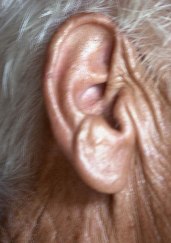 西方人,耳朵,一个人,站,竖图,室内,特写,白天,侧面,欧洲,欧洲人,仅一个男性,仅一个人,站着,仅一个老年男性,老年男性,男人,男性,白种人,耳,耳部,站立,半身,彩图