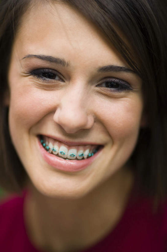 西方人,脸,头,脸颊,头发,一个人,笑,微笑,露齿笑,竖图,室内,特写,白天,正面,欧洲,欧洲人,仅一个年轻女性,仅一个女性,仅一个人,服装,棕色,注视,休闲装,衣服,红色,模型,观察,看,休闲,休闲服,服饰,模具,观看,察看,关注,矫正,牙科,牙套,牙箍,校正,校准,牙饰,年轻女性,女人,女性,白种人,头部,直发,脸部,脸蛋,面部,半身,彩图,短发