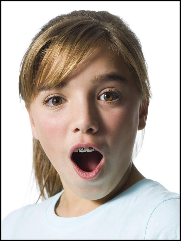 西方人,脸,头,脸颊,头发,一个人,竖图,室内,特写,白天,白色背景,正面,欧洲,欧洲人,仅一个年轻女性,仅一个女性,仅一个人,服装,惊讶,棕色,注视,休闲装,肩膀,衣服,白色,模型,观察,看,张嘴,休闲,休闲服,摄影,服饰,影棚,模具,观看,惊奇,察看,马尾辫,关注,矫正,牙科,牙套,张大嘴巴,牙箍,校正,校准,牙饰,年轻女性,女人,女性,白种人,头部,长发,直发,脸部,脸蛋,面部,张开嘴,半身,彩图,影棚拍摄,拍摄