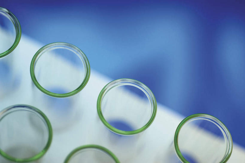 无人,横图,俯视,室内,特写,白天,实验,杯子,一排,许多,阴影,蓝色背景,朦胧,模糊,研究,整齐,反射,分析,化学,测试,试管,试管架,影子,架子,玻璃制品,排列,玻璃瓶,瓶子,摄影,影棚,队列,试验耗材,实验用品,玻璃杯,彩图,高角度拍摄,影棚拍摄,拍摄