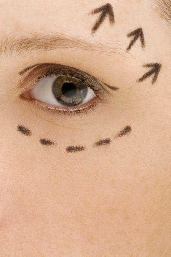 西方人,脸,头,眼睛,脸颊,眉毛,睫毛,一个人,竖图,室内,特写,白天,正面,欧洲,欧洲人,瞳孔,仅一个年轻女性,仅一个女性,仅一个人,注视,方向,标记,箭头,黑色,观察,看,眼部,观看,察看,手术,指向,关注,整形,簇,年轻女性,女人,女性,白种人,头部,睫,脸部,脸蛋,眉,面部,眼,眼睫毛,眼眉,半身,彩图,外科手术,医疗美容外科手术,整形手术,眼眉毛