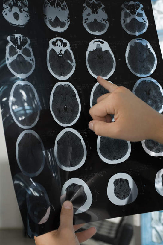 西方人,手,一个人,医生,竖图,室内,特写,白天,正面,机器,欧洲,欧洲人,双手,仅一个男性,仅一个人,握,阴影,反射,医学,影子,拿,拿着,设备,仅一个年轻男性,医护人员,医疗人员,手部,握着,医疗,核磁共振,核磁共振成像,磁共振成像,核磁共振技术,男人,男性,年轻男性,白种人,大夫,半身,彩图