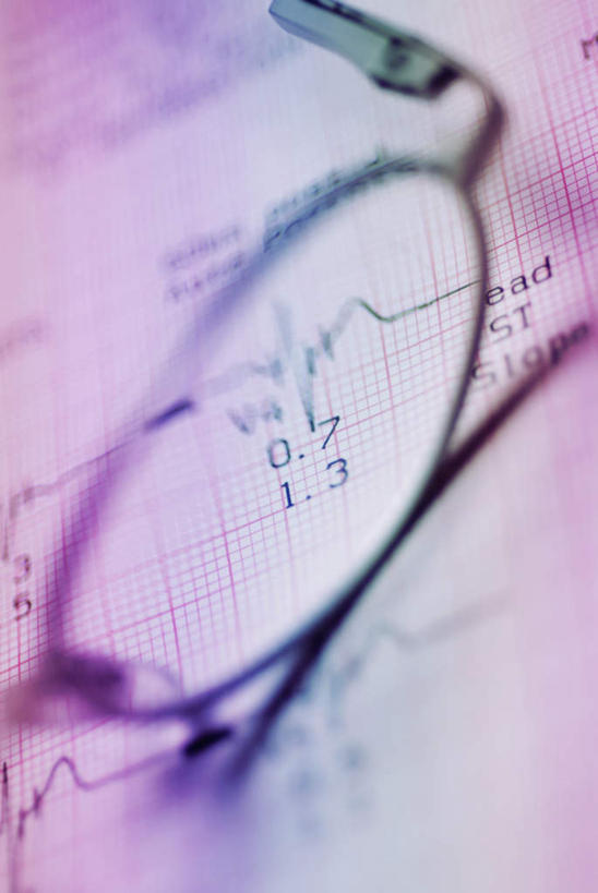 无人,竖图,俯视,室内,特写,白天,静物,一副,阴影,朦胧,模糊,反射,科学,医学,材料,档案,文件,线条,眼镜,影子,纸,手稿,资料,记录,证明,医疗,科学技术,文档,近视眼镜,波动,记载,记实,纪录,彩图,高角度拍摄,脉搏波,病历