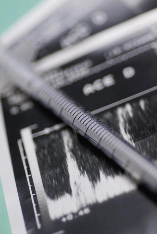 无人,竖图,俯视,室内,特写,白天,静物,阴影,朦胧,模糊,反射,材料,档案,文件,影子,纸,两个,一个,手稿,资料,记录,针管,针筒,注射,摄影,影棚,单个,证明,医疗,医疗设备,注射器,文档,记载,记实,纪录,彩图,高角度拍摄,影棚拍摄,拍摄,病历