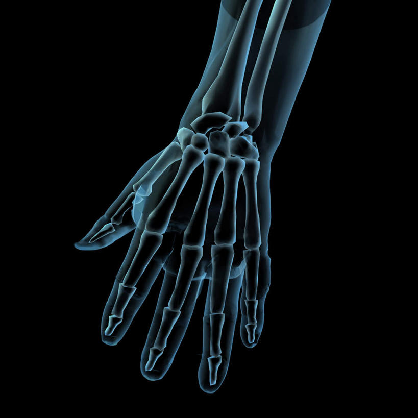 西方人,手,骨骼,一个人,无人,方图,插画,x光片,室内,特写,白天,正面,数码,科技,欧洲,欧洲人,仅一个男性,仅一个人,阴影,辐射,科学,网络,医学,骨头,高光,几何,计算机图形,合成,图画,画,仅一个年轻男性,手部,单手,电脑合成图,数码合成图,骨架,医疗,科学技术,x射线,合成图,x光,漫画,写实,具体,具象,尺骨,肱骨,桡骨,腕骨,掌骨,指骨,男人,男性,年轻男性,白种人,半身,彩图,电磁波,电磁辐射