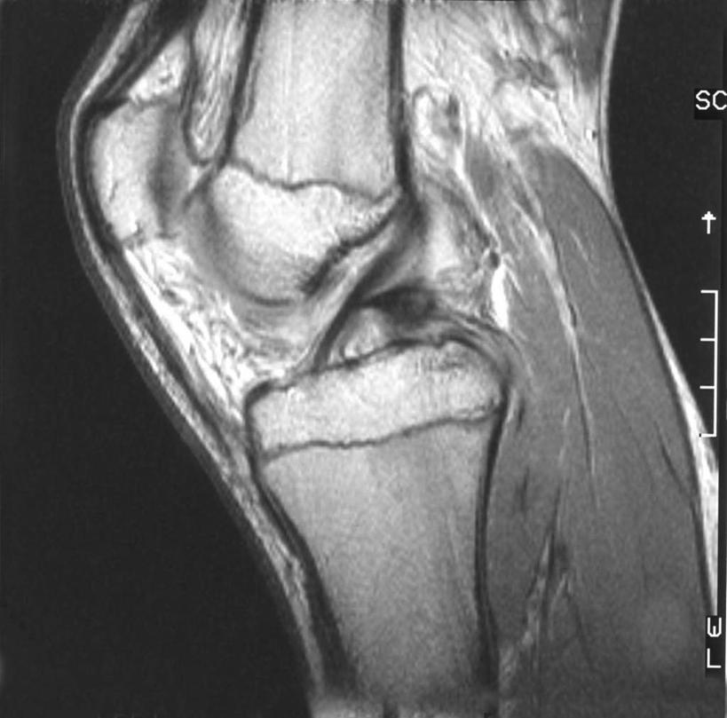 骨骼,无人,横图,x光片,室内,特写,白天,正面,黑色背景,辐射,科学,医学,骨头,摄影,影棚,骨架,医疗,科学技术,x射线,x光,韧带,髌骨,腓骨,股骨,胫骨,彩图,影棚拍摄,拍摄,电磁波,电磁辐射