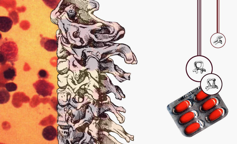 脊椎,无人,横图,插画,室内,白天,白色背景,正面,安全,数码,科技,一排,许多,阴影,整齐,网络,药剂,塑料,防护,很多,高光,几何,计算机图形,合成,图画,胶囊,盒子,画,排列,一个,红色,包装盒,容器,塑料制品,药品,治疗,单个,储藏,保护,药物,电脑合成图,数码合成图,医疗,合成图,储存,队列,保险,预防,漫画,写实,具体,具象,平安,彩图,吸塑包装盒,贮存