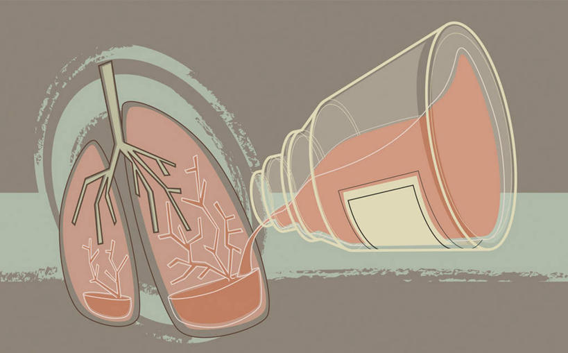 内脏,肺,气管,动脉,静脉,无人,横图,插画,室内,白天,正面,安全,数码,科技,静物,阴影,网络,医学,药剂,防护,高光,几何,计算机图形,合成,图画,画,红色,模型,瓶子,塑料制品,药品,塑料瓶,治疗,人体,保护,药物,电脑合成图,数码合成图,医疗,生物学,人体器官,一瓶,器官,合成图,保险,预防,漫画,呼吸道,支气管,生理学,写实,具体,具象,支气管树,呼吸系统,下呼吸道,平安,肺部,肺脏,彩图