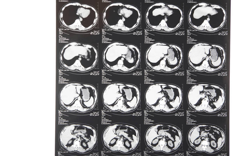 无人,x光片,亚洲,检查,辐射,科学,医学,医疗,科学技术,x射线,x光,彩图,电磁波,电磁辐射