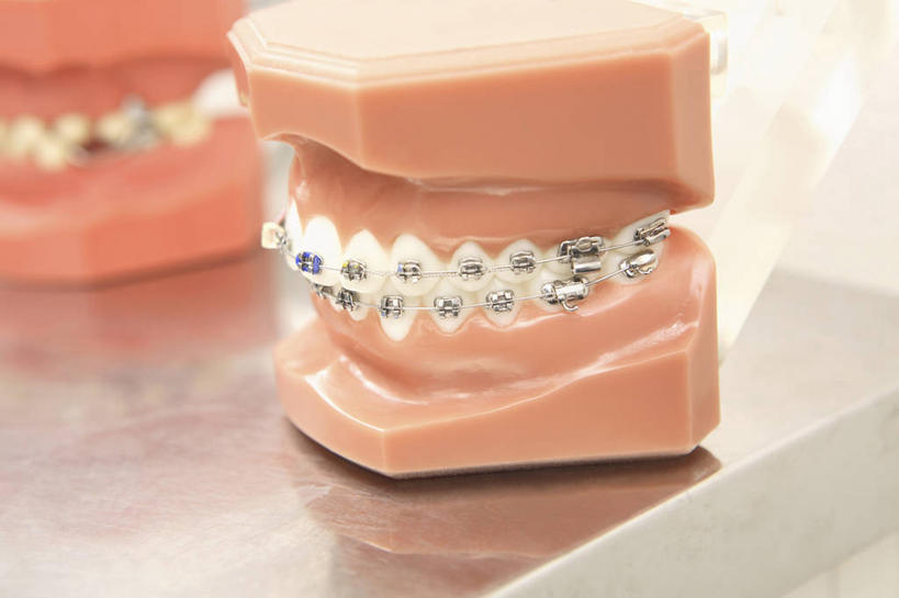 牙齿,无人,静物,模型,牙科设备,口腔卫生,齿,牙,牙龈,彩图