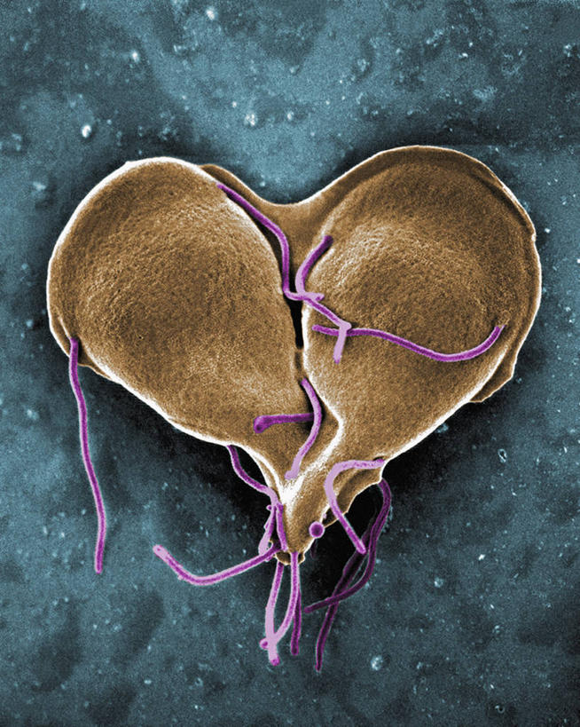 无人,竖图,科学,无脊椎动物,动物,生病,摄影,鞭毛,寄生虫,贾第虫,贾第虫病,有丝分裂,原生动物,心型,彩图,电子显微镜,蓝伯贾第虫,蓝氏贾第鞭毛虫,蓝氏贾第虫