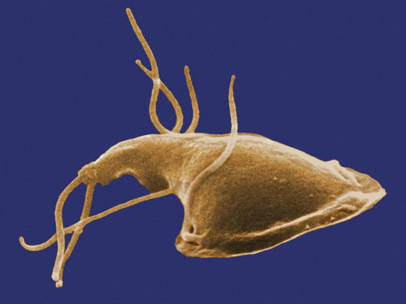无人,横图,科学,无脊椎动物,动物,生病,摄影,鞭毛,寄生虫,贾第虫,贾第虫病,原生动物,彩图,电子显微镜,蓝伯贾第虫,蓝氏贾第鞭毛虫,蓝氏贾第虫